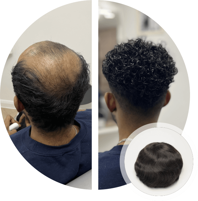 Men's Hair Systems Before & After