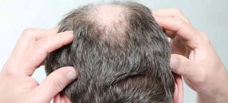 Men Doing Gentle Scalp Massages