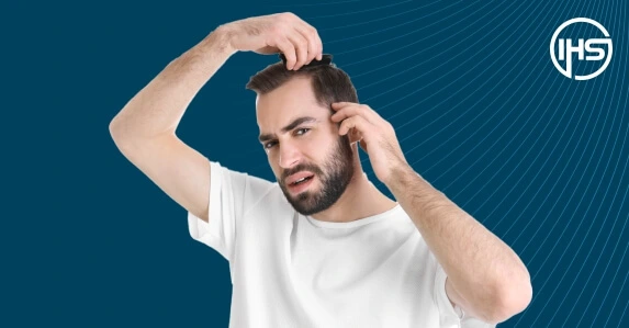 Risks of Ignoring Hair Loss Early On